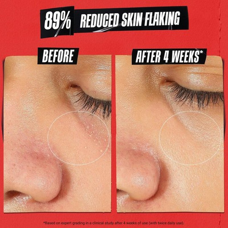 Kiehl's Ultra Facial Recovery Barrier Cream - Lightweight Moisturizing Lotion for Dry & Sensitive Skin