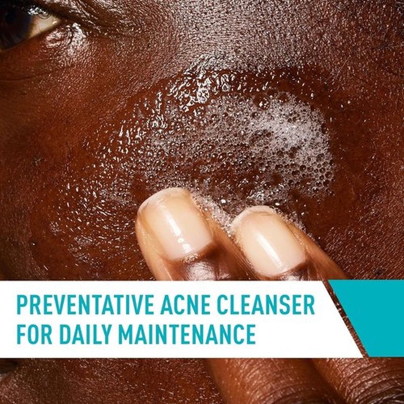 CeraVe Acne Control Cleanser - 2% Salicylic Acid & Niacinamide | Gentle Fragrance-Free Face Wash, 16 Ounce