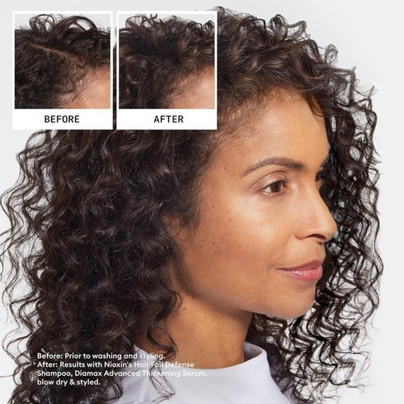 Nioxin Hair Fall Defense Shampoo - Activates Hair Follicles for Less Hair Loss | With Lauric Acid, Caffeine, Niacinamide