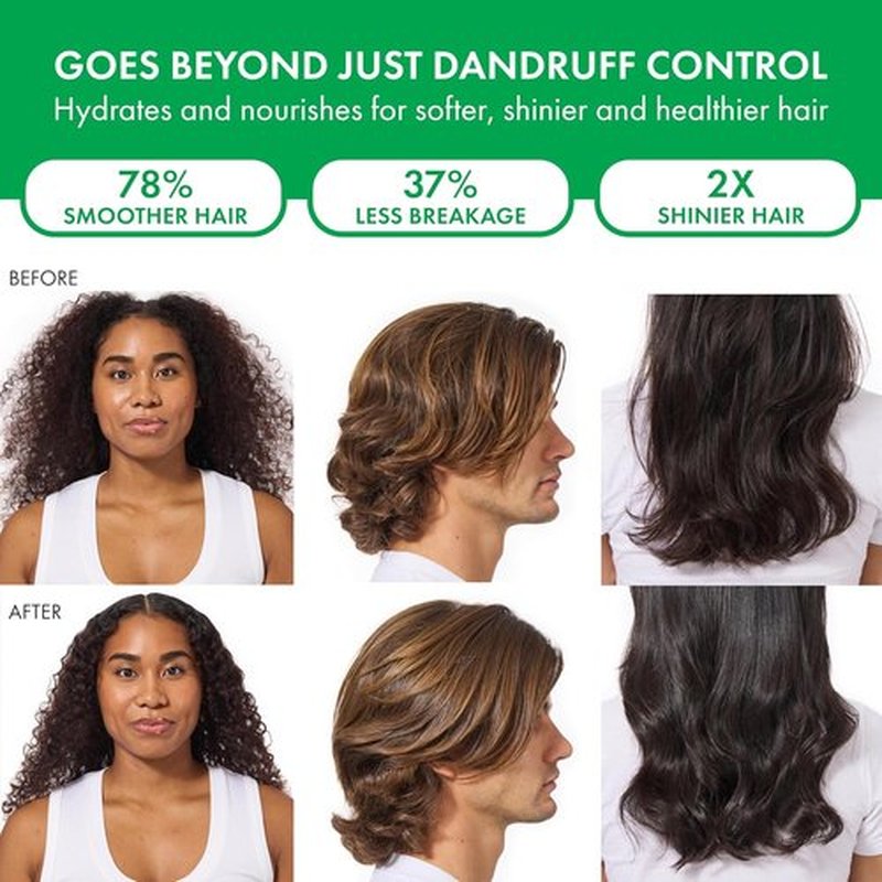 Dercos Dandruff Shampoo - Antifungal Treatment for Itchy Scalp Relief | Prescription Strength Selenium Sulfide