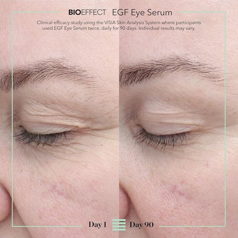 BIOEFFECT EGF Eye Serum - Age-Defying Under Eye Treatment with Rollerball for Puffiness & Fine Lines | 6 mL
