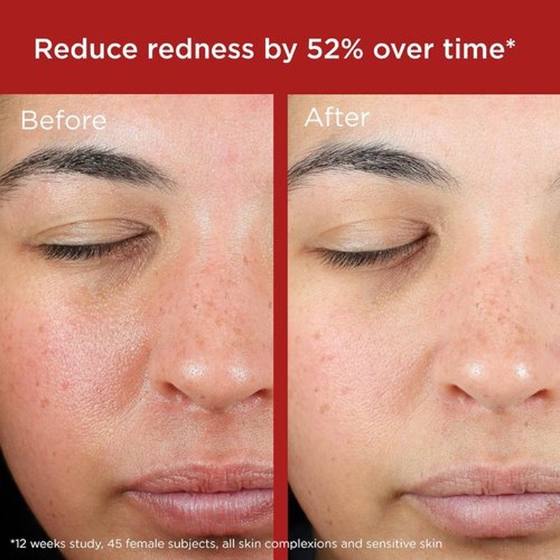 EltaMD UV Skin Recovery Face Sunscreen - All Mineral SPF 50, Zinc Oxide Formula for Sensitive Skin