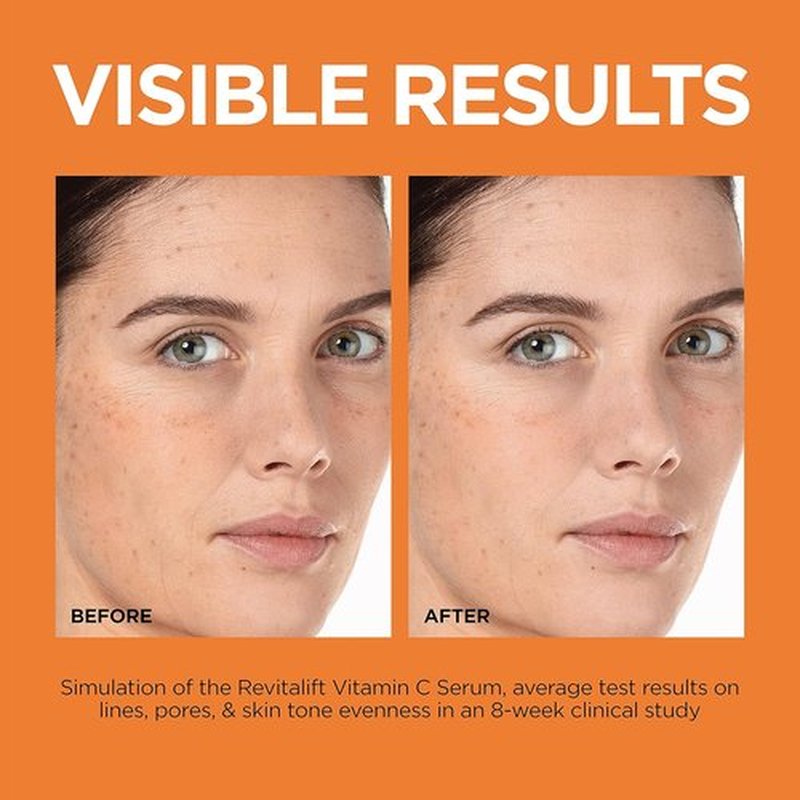 L'Oreal Paris Revitalift Vitamin C Serum - Brightening Face Serum with Vitamin E & Salicylic Acid, 1 oz