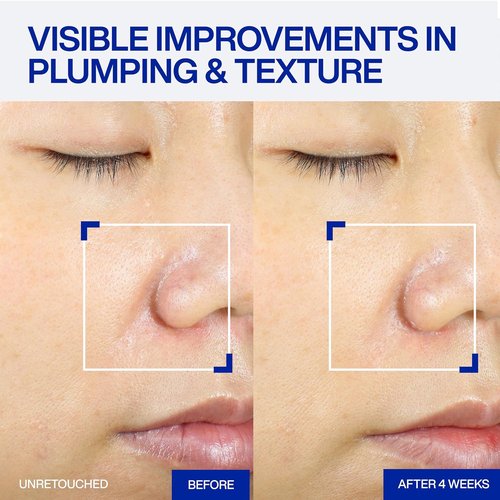 IOPE XMD Stem III Clinical Recovery Serum - Professional PDRN Treatment for Firm, Plump Skin - 1.69 fl. oz.