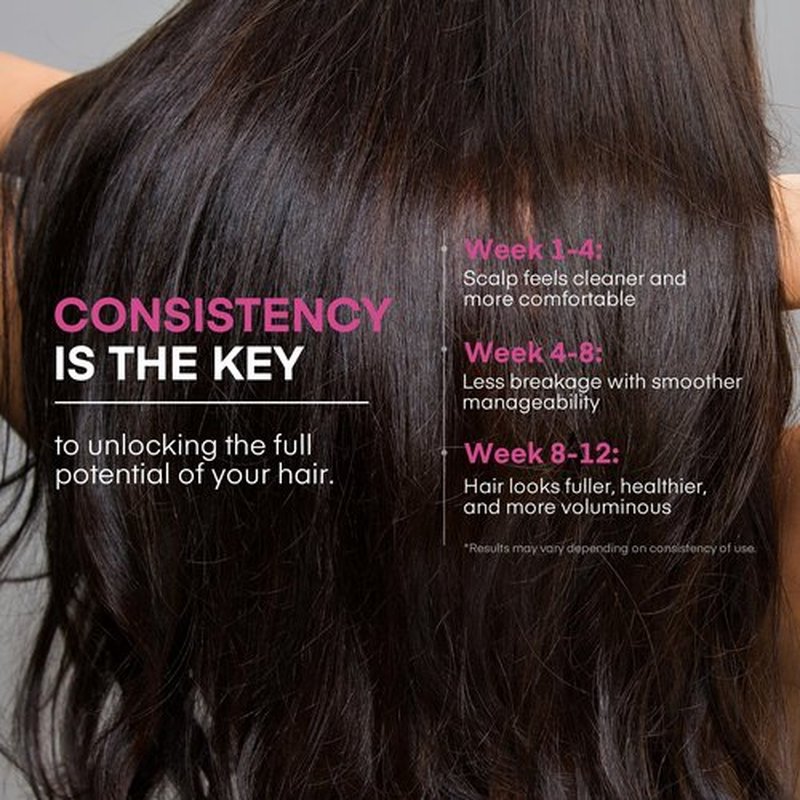 Svvimer Onion Rosemary and Biotin Shampoo - Hair Growth Shampoo for Hair Loss and Thinning - Thickening and Strengthening Formula for Men & Women Sulfate Free 13.5 Fl Oz (Pack of 1)