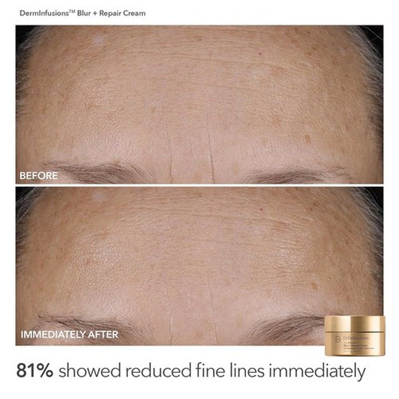 Dr. Dennis Gross Plump & Smooth Kit - DermInfusions™ Blur & Repair Cream (0.67 oz) + 5 Alpha Beta® Peels | $50 Value