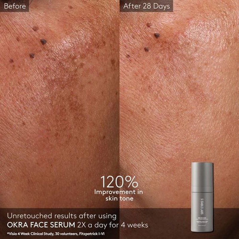 S'ABLE Labs - Okra Face Serum | Boost Elasticity, Stimulate Collagen, Replenish Skin Barrier | Retinoid + African Resurrection Plant | Melanin-Inclusive Skincare (30 mL | 1 fl oz)